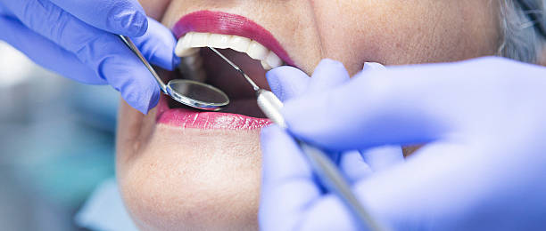 Best Emergency Wisdom Teeth Removal in Kraemer, LA